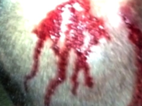 Photo Of Zimmerman's Bloodied Head Released