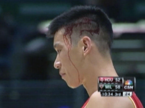 Jeremy Lin Suffers Bloody Head Injury Against Bucks