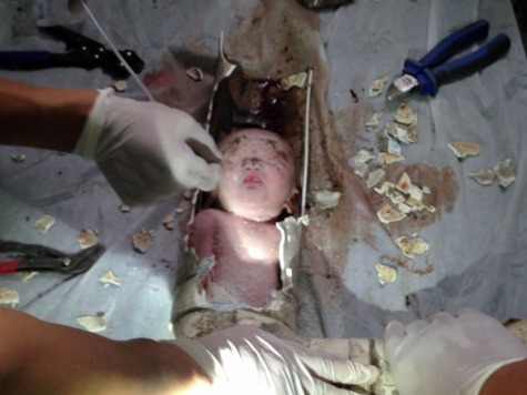 Mother of Chinese Baby Found in Sewer Pipe Hid Her Pregnancy