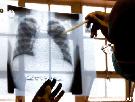 SOURCE: Breitbart Texas Reporting Leads to Apprehension of Illegal with Tuberculosis