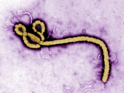 Report: 1,400 People in US Being Monitored for Ebola