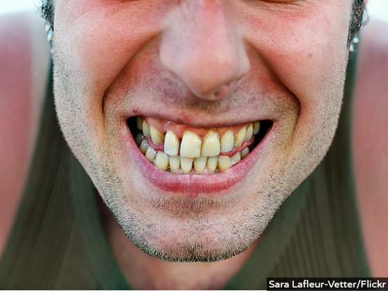 Man Makes Prison Break to See Dentist